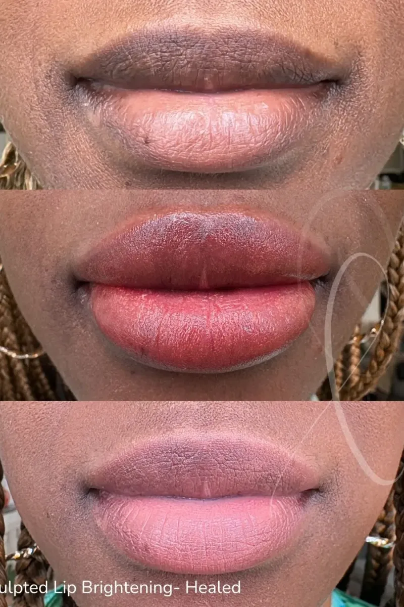 29
