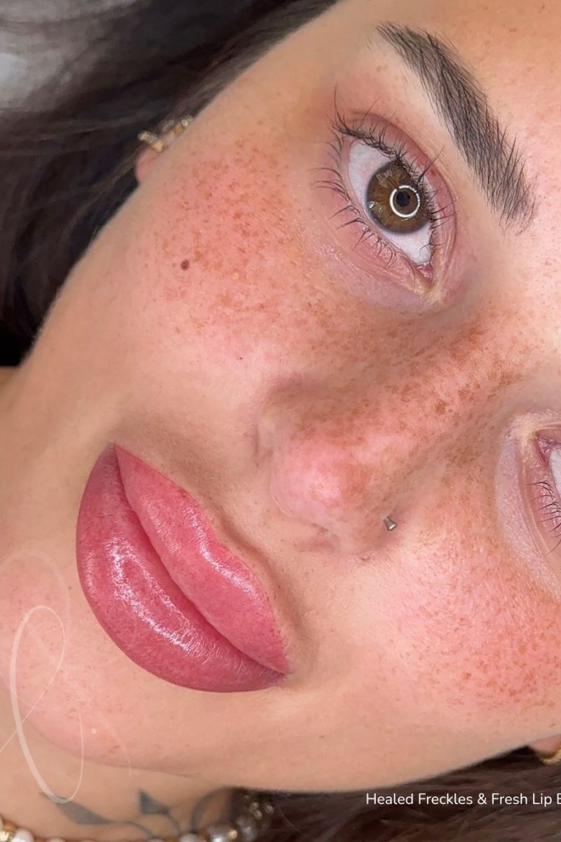 35