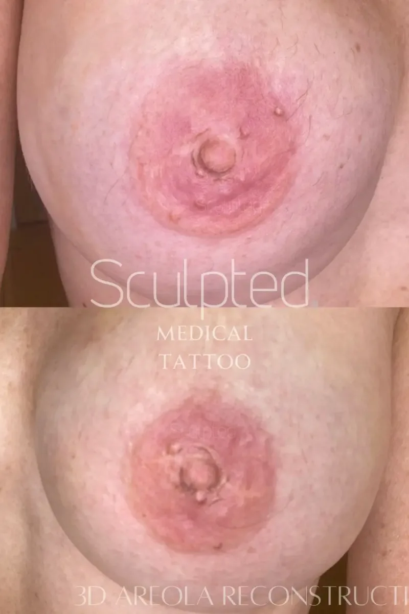 Full 3D Reconstruction