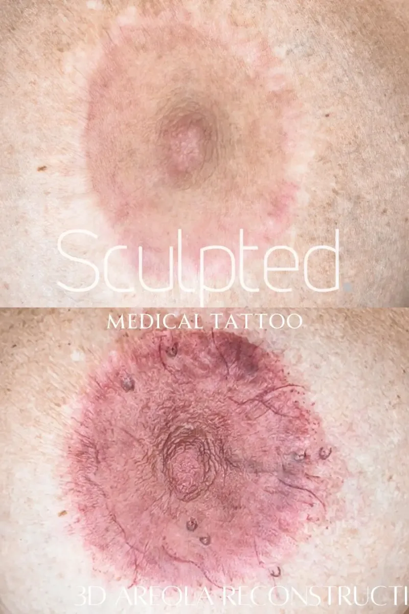 Enhancement & Scar Camoflague